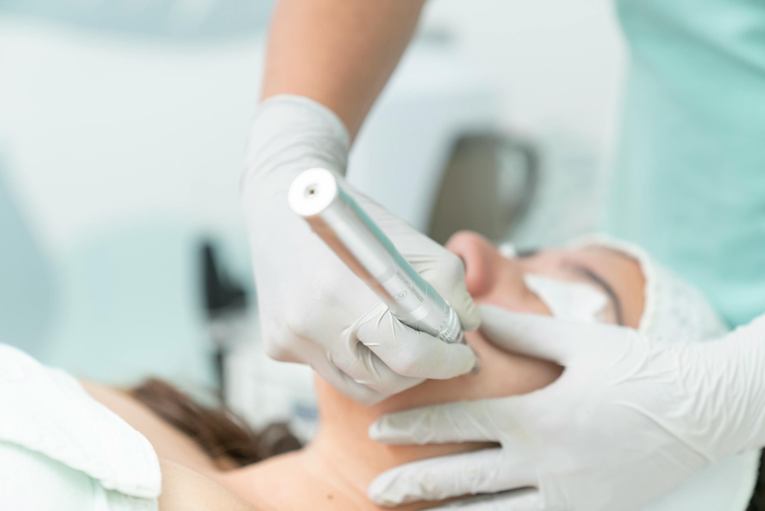 Face Treatments to Prep Your Skin Before a Big Event